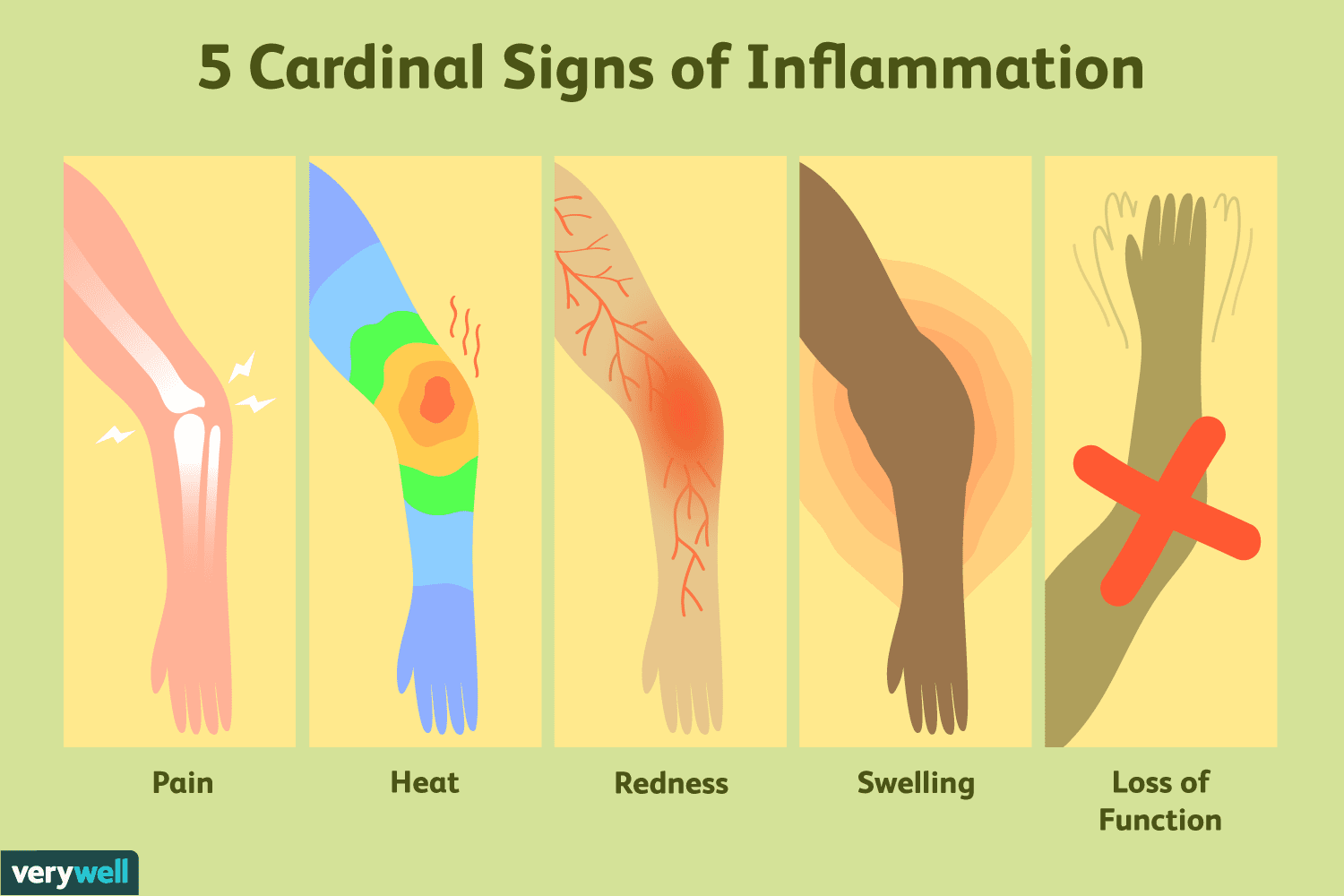 Diagnostic Features of Acute Inflammation: Beyond The Redness; Diagnostic Clues