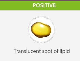 Spot Test: Qualitative Identification of Lipids